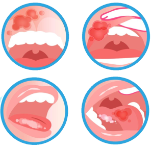 GelX Oral Spray Спрей Джеликс для защиты слизистой оболочки полости рта для профил. мукозита, 100 мл. Фото N4