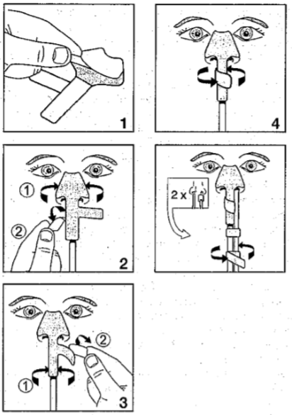 NASO-FIX 4.jpg NASO-FIX 4.jpg