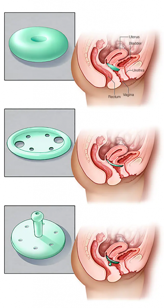 gynecology-1.png