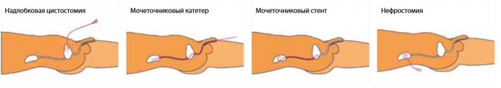 урология.png урология.png