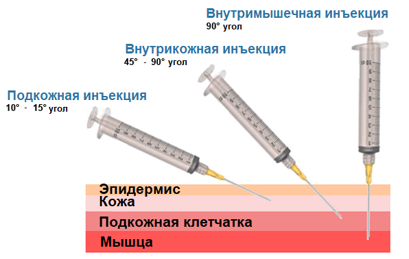 прокол.png прокол.png