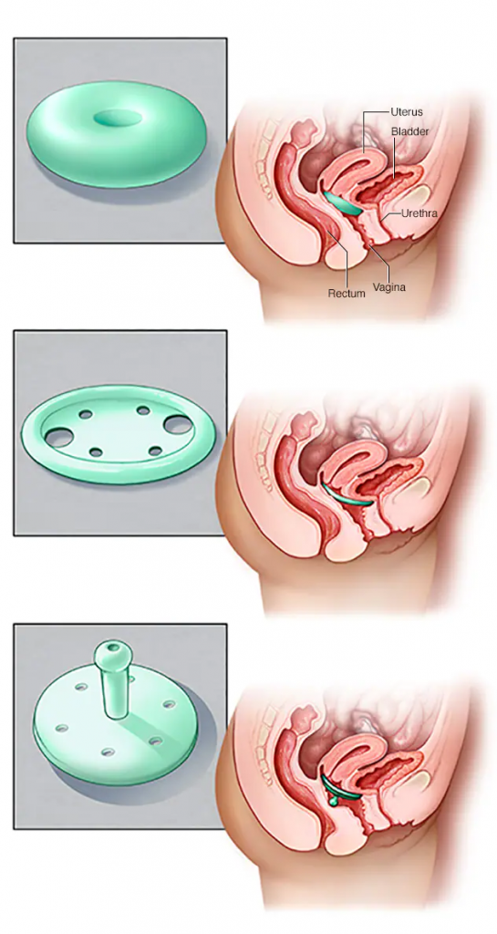 gynecology-1.png gynecology-1.png